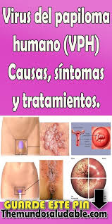 Check spelling or type a new query. Papiloma Virus Sintomas Y Tratamiento Papiloma Sintomas Y Tratamiento Mult Mai Mult Decat Documente