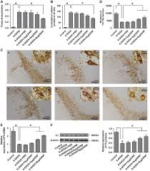 We did not find results for: Transcription Factor Six2 Mediates The Protection Of Gdnf On 6 Ohda Lesioned Dopaminergic Neurons By Regulating Smurf1 Expression Cell Death Disease