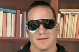 What happened to AJ Hawk's face?