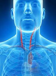 Oftentimes neck pain is located in one spot and goes away on its own within a few days or weeks. Narrowing Of The Carotid Arteries May Lead To Memory And Thinking Problems
