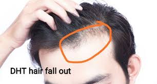 I could hear them arguing. Has Anyone Ever Successfully Grown Back Their Hair After Experiencing Hair Loss Or Baldness What Did It Quora