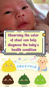 Image result for Newborn Stool Color