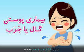 بیماری گال علائم علت و درمان Skin Problems Family Guy Fictional Characters