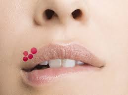 Two herpes subtypes may cause these sores. Herpes Facts Everyone Should Know Self