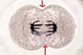Maybe you would like to learn more about one of these? Do You Find A Cleavage Furrow In Mitotic Plant Cells Quora