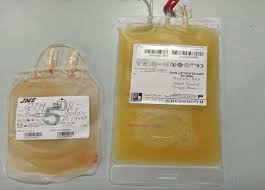 Image result for Platelet Transfusion