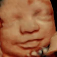 A Moment in Time Prenatal Imaging Lake Charles
