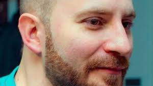 Thinning hair and male pattern baldness eventually affect a large percentage of men. 15 Best Hairstyles For Balding Men