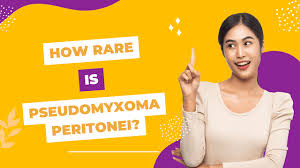 Image result for Pseudoeriosema