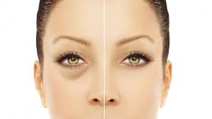 Help I Have Dark Circles Under My Eyes Elysee Scientific Cosmetics Eye Cream For Dark Circles Puffy Eyes Homemade Wrinkle Cream