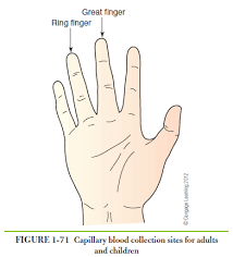 Image result for Capillary Puncture