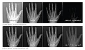 understanding radiology exposure indicators everything rad