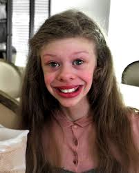 Bess is a little girl with a charming smile., In addition to an inspiring  and tender personality., That's why she has been called "the happiest girl  in the world"., However, that smile has another ...