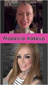 Wee ALOPECIA makeup video