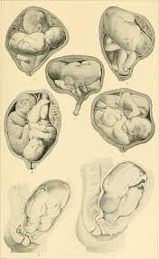 Image result for Compound Presentation