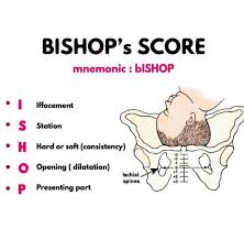 Image result for Bishop Score