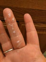 If you have cramps, white discharge, and no period, you may be wondering if you're pregnant. Late Period Chunky White Discharge Glow Community