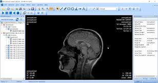 No downloads or installation required. Top 25 Free Dicom Viewers For Doctors Medical Students And Health Professionals Postdicom