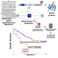 mesothelioma prognosis a prognosis is the course doctors predict the disease will take. A Bap1 Synonymous Mutation Results In Exon Skipping Loss Of Function And Worse Patient Prognosis Sciencedirect