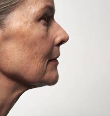 Is olive oil beneficial against skin aging? — Typology