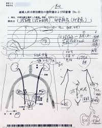 子宮筋腫開腹手術】入院1日目:手術説明 | レモンねーどの病気日記