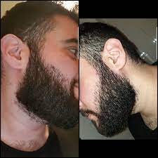 6 7 Weeks Of Growth But A Very Coarse Beard Beard Hair Styles Growth