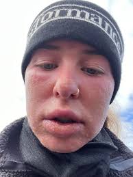 Hey guysss, as requested here is my summit 😄 I got really sick and had no  sleep or food or water the last days so summit night was really hard. I got