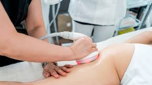 It causes the skin to shrink. How Does Ultrasonic Cavitation Work To Remove Fat