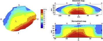 If you have telegram, you can view and join. First Application Of A Pixel Wise Analysis On Bladder Dose Surface Maps In Prostate Cancer Radiotherapy Radiotherapy And Oncology