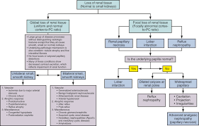 Renal Parenchymal Disease Grade 1 I Causes And Treatment I Grade 1 Kidney  Failure - Youtube