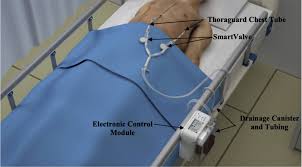 Image result for Small Caliber Chest Tube
