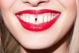 Biting The Inside Of Your Cheek By Accident Natalia Siodmiak By Terry Richardson Red Lip Lips Lipstick Makeup Pink Lips Gap Teeth Lips