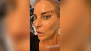 Смотрите видео siegel giulia в высоком качестве. Hat Giulia Siegels Schlupflid Behandlung Gefruchtet