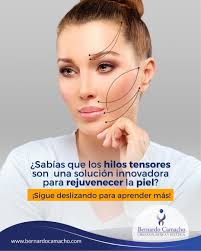 ✨ ¡Descubre el Secreto de los Hilos Tensores! ✨ ¿Buscas una piel más firme  y rejuvenecida? Los hilos tensores son la solución innovadora que estabas  esperando. 🙌✨ ✨ Resultados inmediatos ✨ Mínimamente