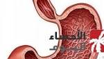 نصائح لتحسين الهضم وإزاحة القلق