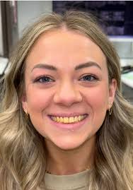 The Girl with The Brown Teeth