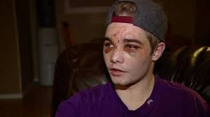 Regina man, 18, beaten