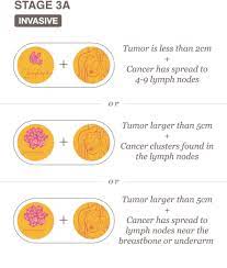 If the cancer has spread to other parts of the body (secondary breast cancer), this also increases the risk. Stages Archives National Breast Cancer Foundation