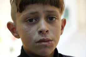 Medical Mission to Jordan: The faces of Syrian refugees and their health  struggles after years of war