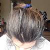 Best hair loss treatment for men and in women treatment may slightly vary in terms of medicines apply. 1