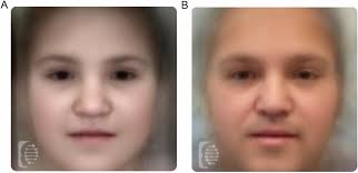Myhre syndrome in adulthood: clinical variability and emerging  genotype-phenotype correlations