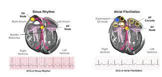 How long does it take to recover from long covid? Doc Dr Osman Beton Electrical Cardioversion