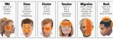 A Cure For Your Headaches Migraines Pain Specialist Physiotherapist