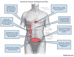 Organs on the left side of your abdomen that might cause pain include: Pin On Educational Medical Diagrams