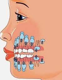 Zahngesundheit von babys und kleinkindern | wann kommen die ersten bleibenden zähne? Dentition Der Durchbruch Der Zahne