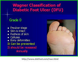 Pin On Diabetic Foot