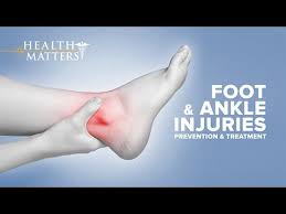 Foot And Ankle Injuries Health Matters Youtube