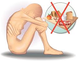 Image result for eating disorder symptoms