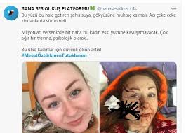 Yüzünde derin yaralar bulunan butim, eski kocam yaptı. Npghvblhvr 3om