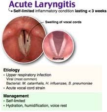 Image result for Acute Laryngitis